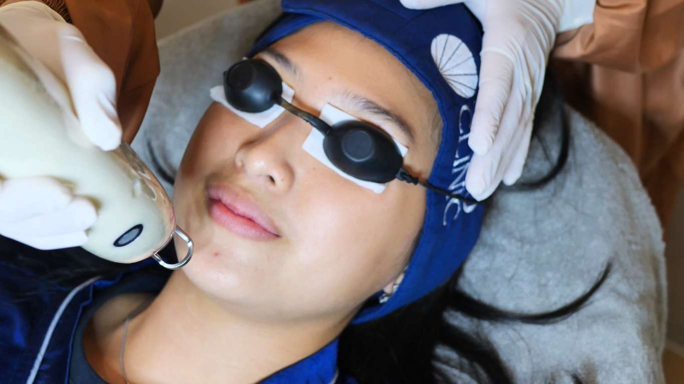 Nano Laser Treatment Sozo Clinic