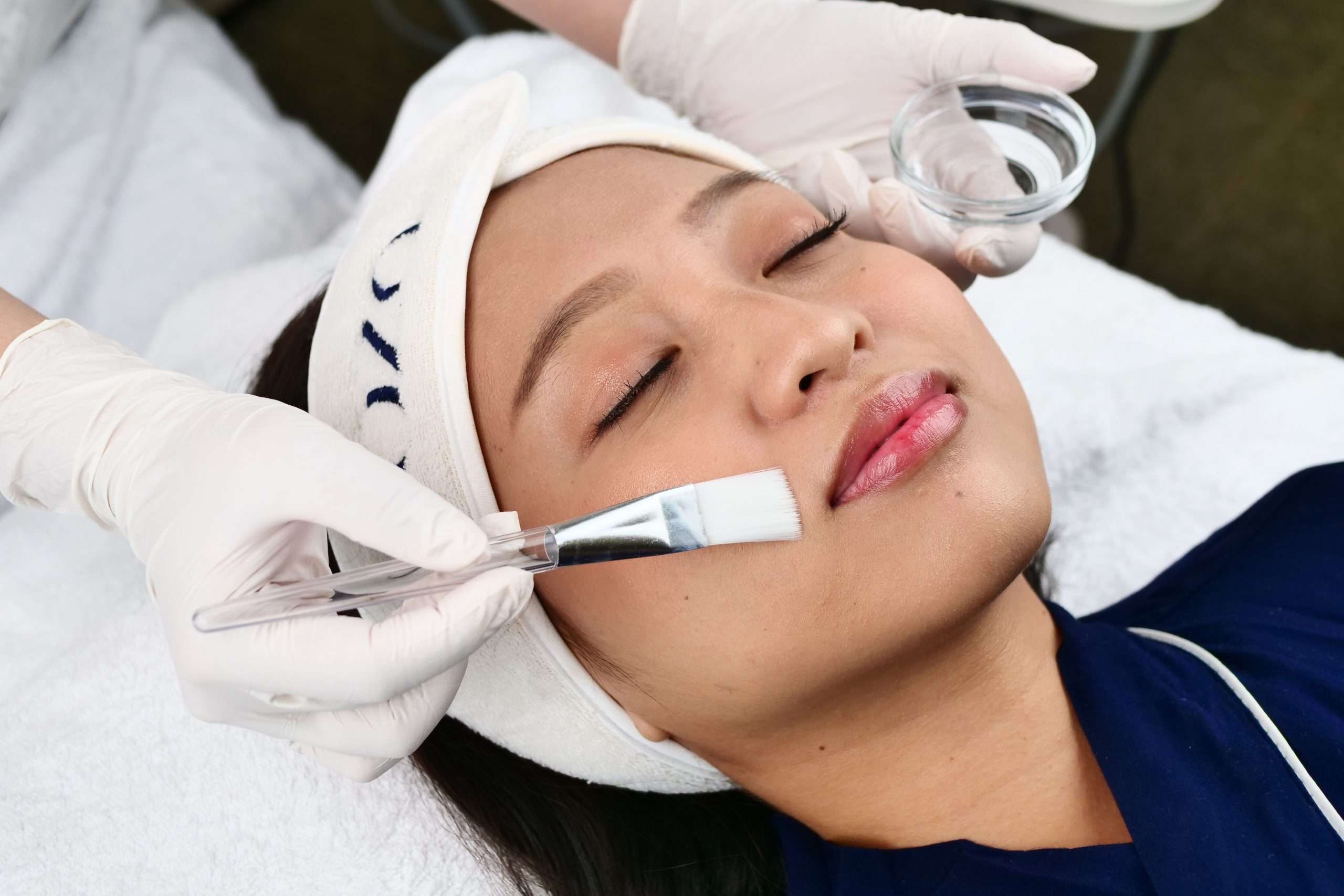 Derma Peel Treatment Sozo Skin Clinic