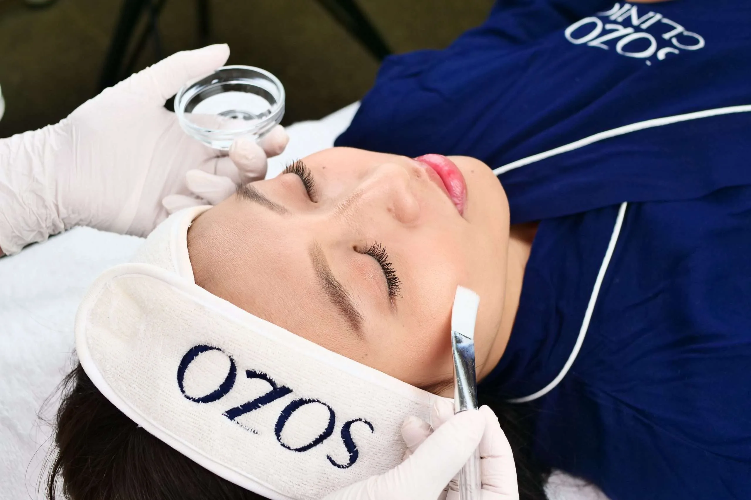 Derma Peel Treatment