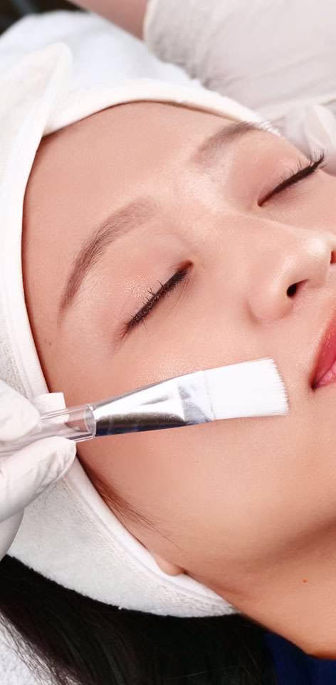 dazzling glow peel - sozo skin clinic - derma peel treatment