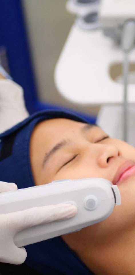 laser HIFU - sozo skin clinic