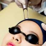 pico laser - sozo skin clinic