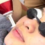 laser treatment - pink lips sozo skin clinic