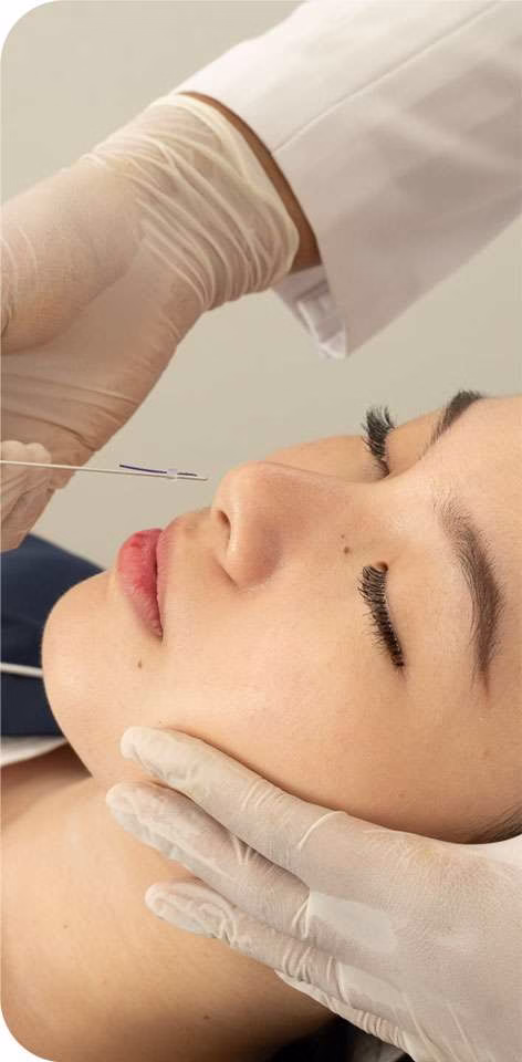 threadlift treatment - perfect nose job - sozo skin clinic