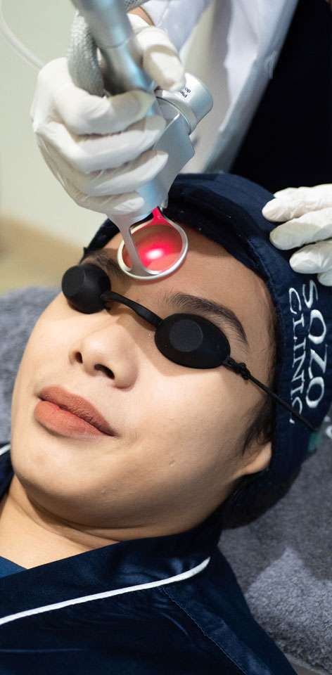 laser co2 treatment - sozo skin clinic