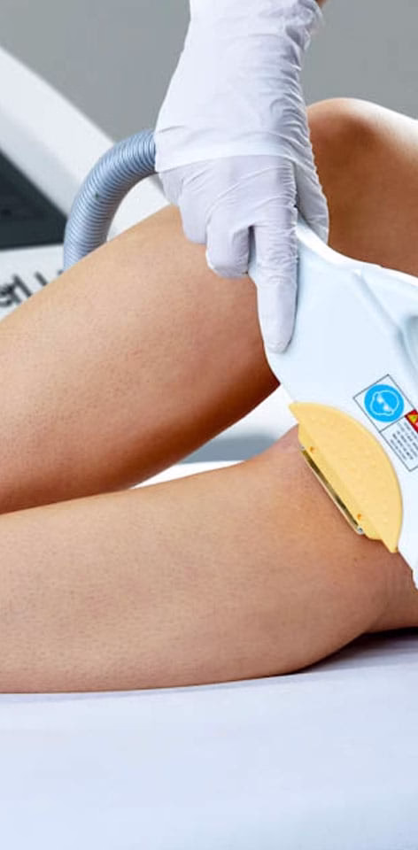 hair removal medium large - sozo skin clinic