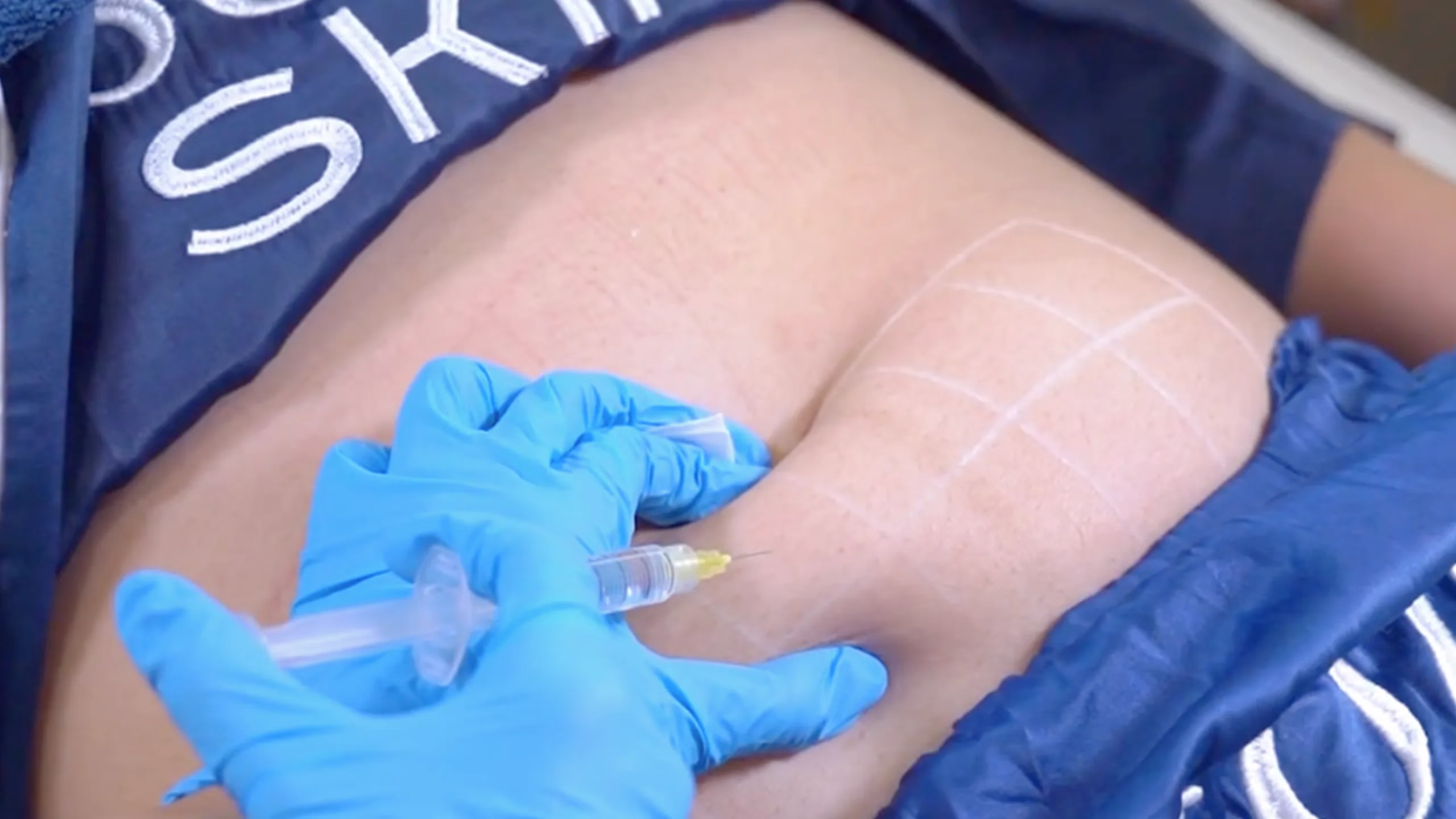 meso-metabolic-boost