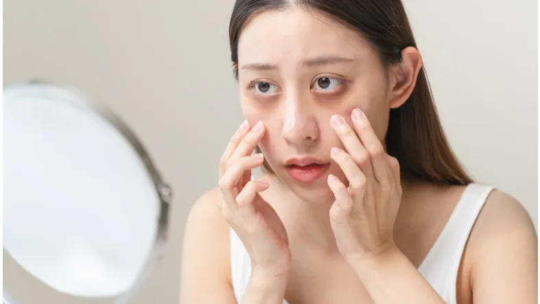 7 Penyebab Mata Panda pada Anak Muda & Cara Mengatasinya