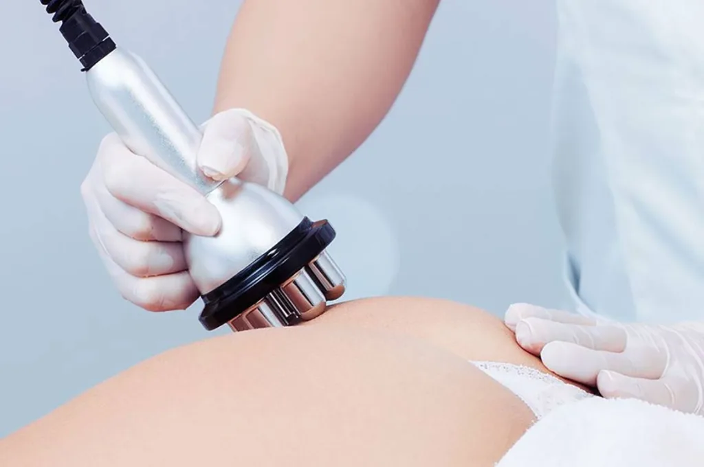 radiofrequency ablation