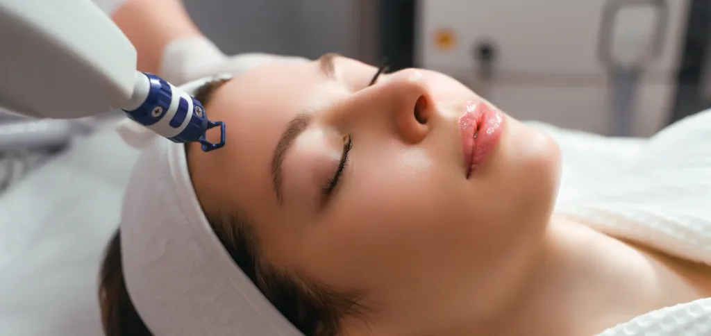 Laser untuk menghilangkan dark spot