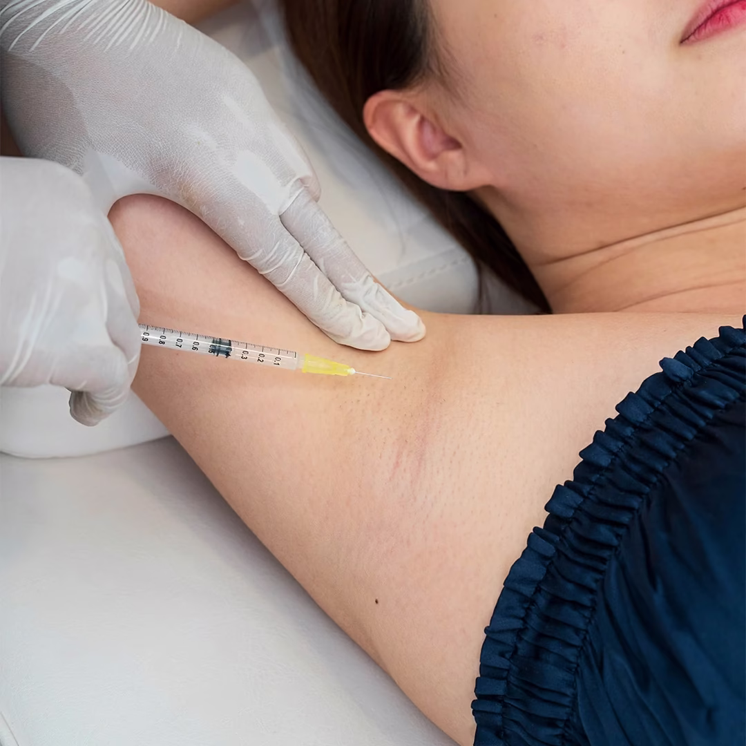 Botox Underarm Ketiak Treatment