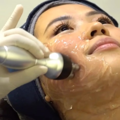 Radiofrequency Wajah