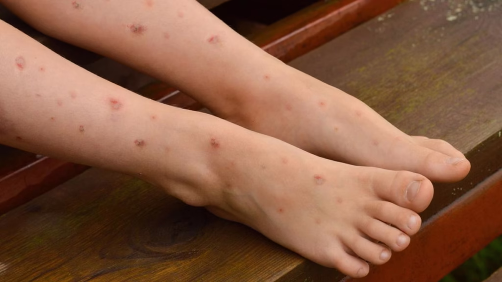 Cara Menghilangkan Bekas Luka yang Menghitam: Panduan Lengkap & Efektif