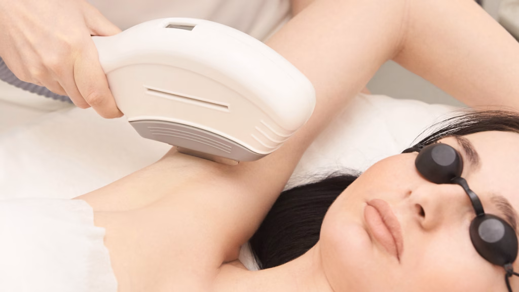 IPL underarm treatment di klinik